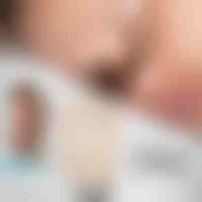 Dilatateur nasal magnétique | EASYBREATHE